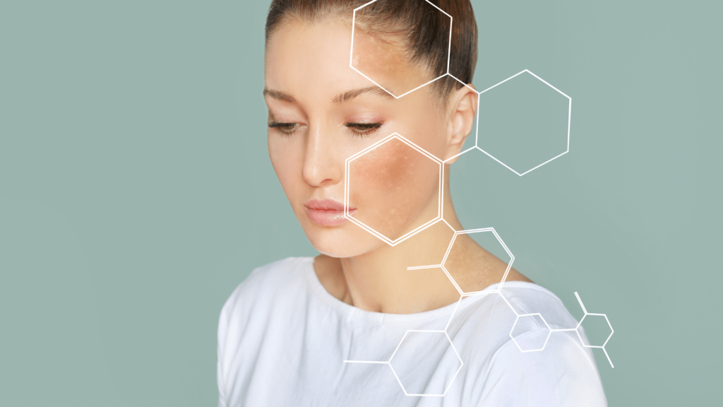 hormonal pigmentation treatment